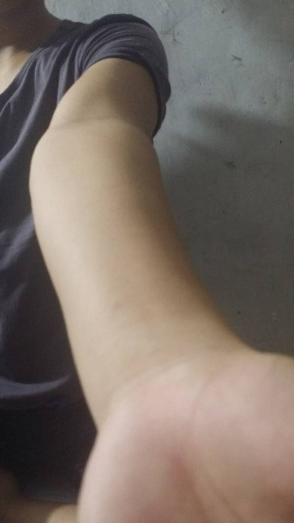 肘外翻20度，兵检过了，挑战与机遇并存，肘外翻20度，兵检通过的挑战与机遇并存之路