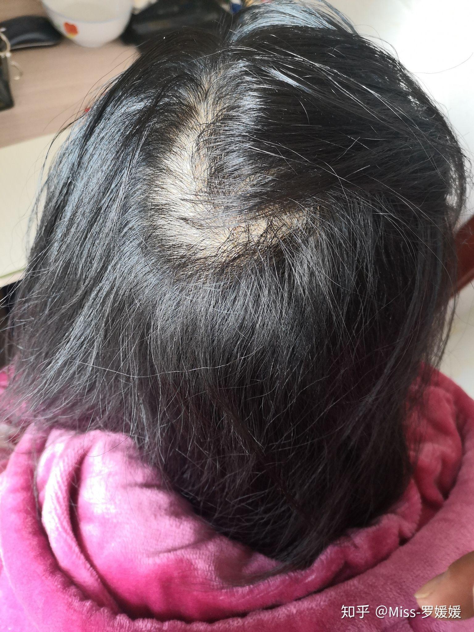 今天可以剪头发吗?——一场关于发型、个人选择与日常生活的思考,日常发型选择,个人自由与日常思考的重要性