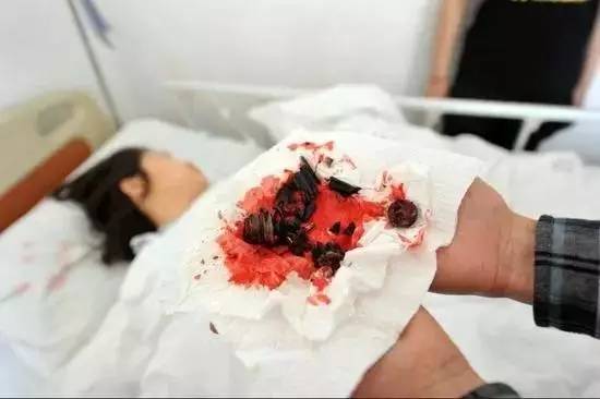 下体藏手榴弹，一种极端行为的背后解析，极端行为背后的真相，下体藏手榴弹的心理与动机解析